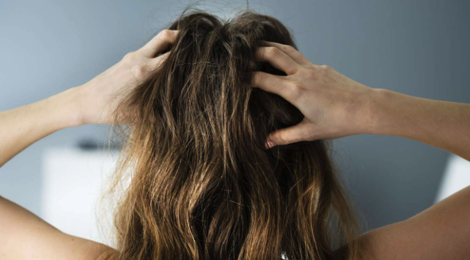 핀페시아 탈모에 대한 신뢰할 수 있는 솔루션